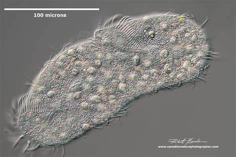  Did You Know That The Kentropyx Is A Ciliate With An Intricate Ciliature Arrangement, Allowing It To Swim And Capture Prey Efficiently?